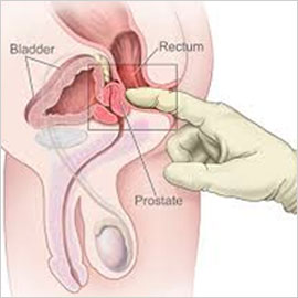 Prostate
