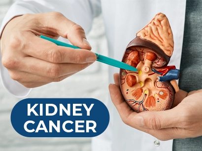 Kidney Cancer: Understanding, Prevention, and Treatment