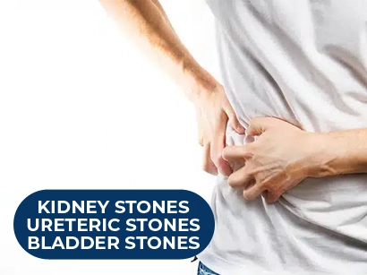 Kidney Stones/Ureteric stones/ bladder stones